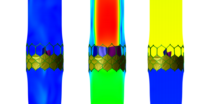Sapien 3 in vitro level FSI simulation shown at three flow states.