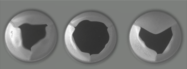 Experimental leaflet images during opening, open state and closure.